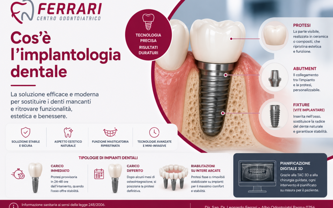 Cos’è l’implantologia dentale?