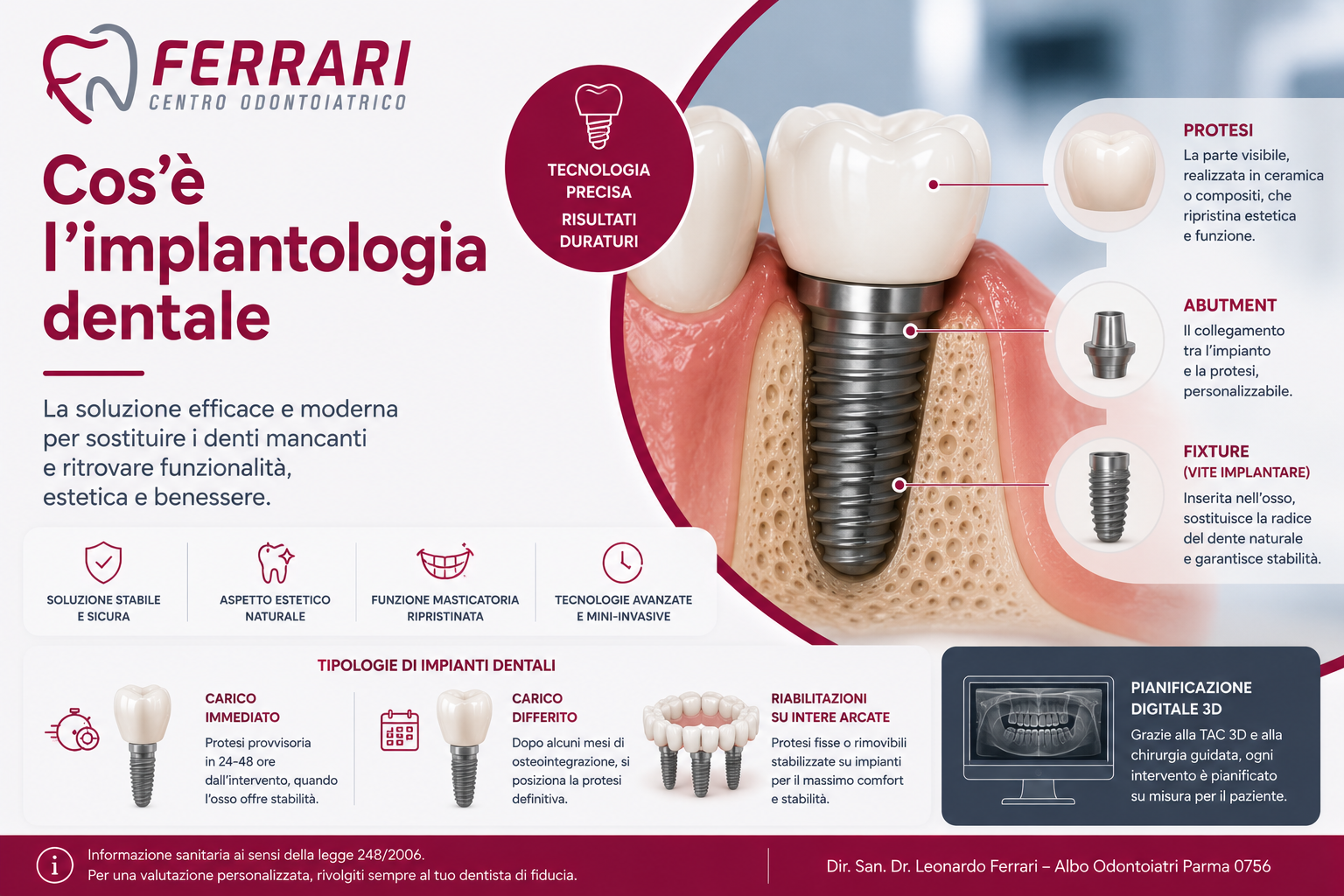 impianti-dentali-soluzioni-moderne-sicure