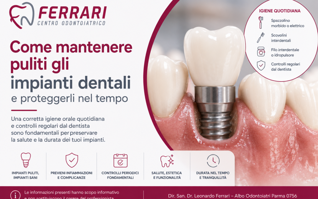 Come mantenere puliti impianti dentali