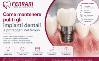 Come mantenere puliti impianti dentali