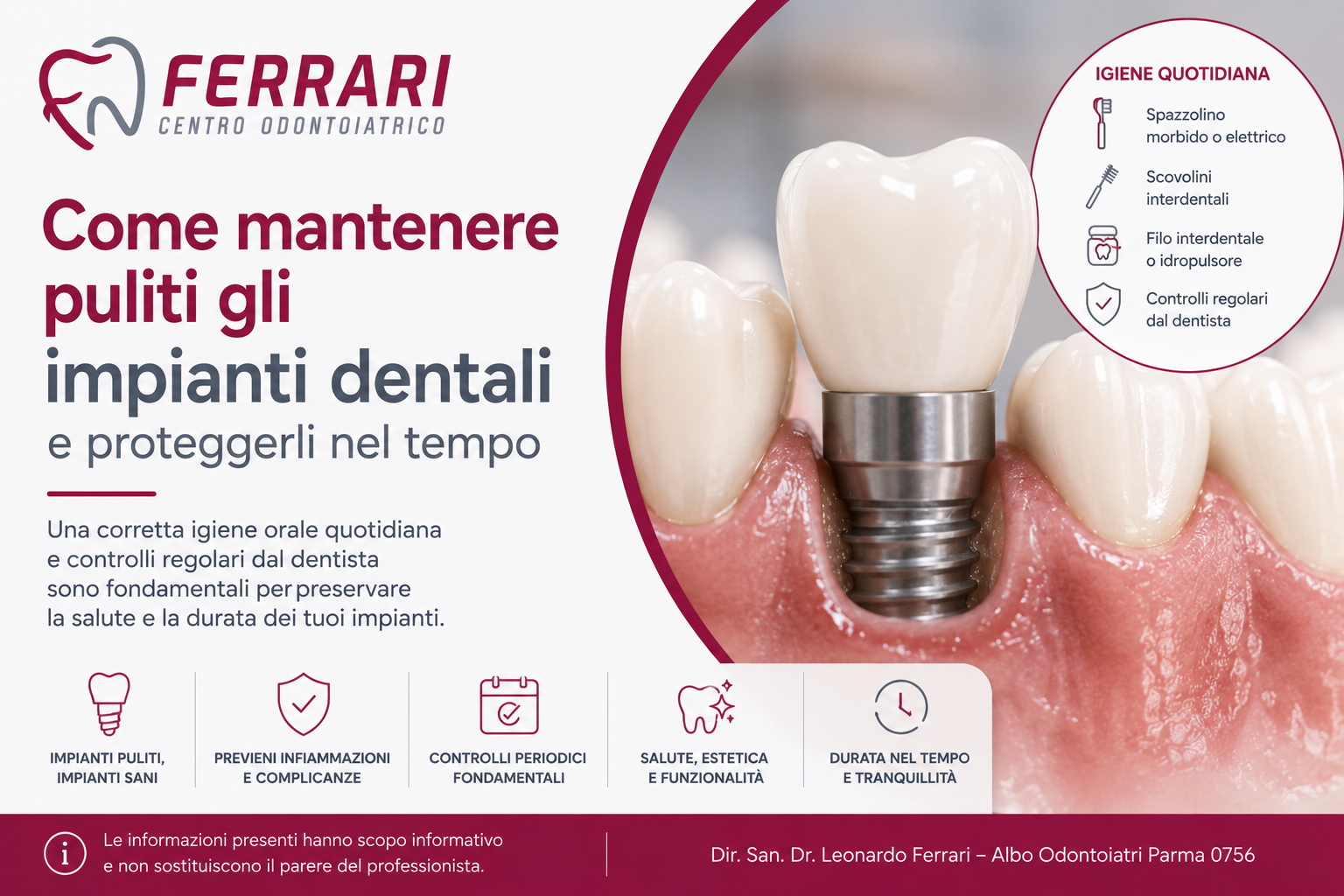 impianti-dentali-articolo-centro-odontoiatrico-ferrari
