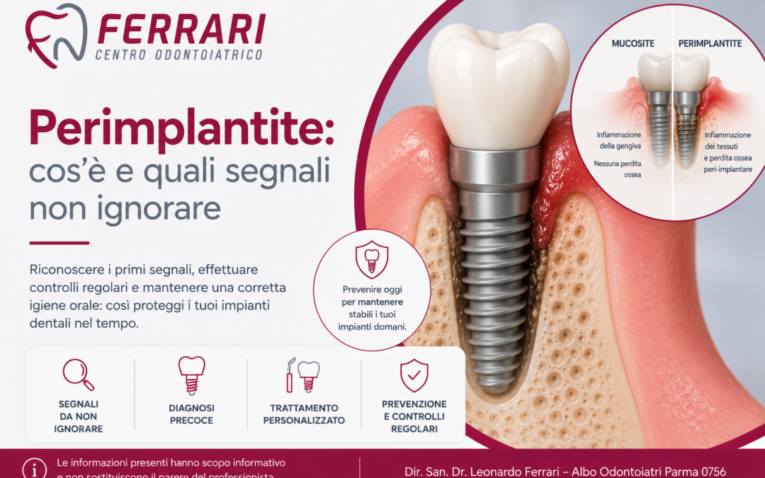 Perimplantite: sintomi, cause e segnali da non sottovalutare | Parma