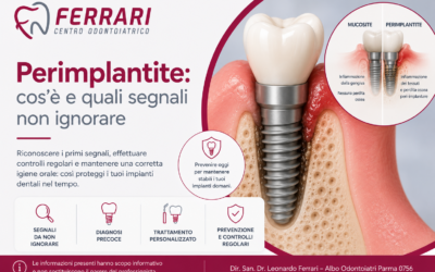Perimplantite: sintomi, cause e segnali da non sottovalutare | Parma
