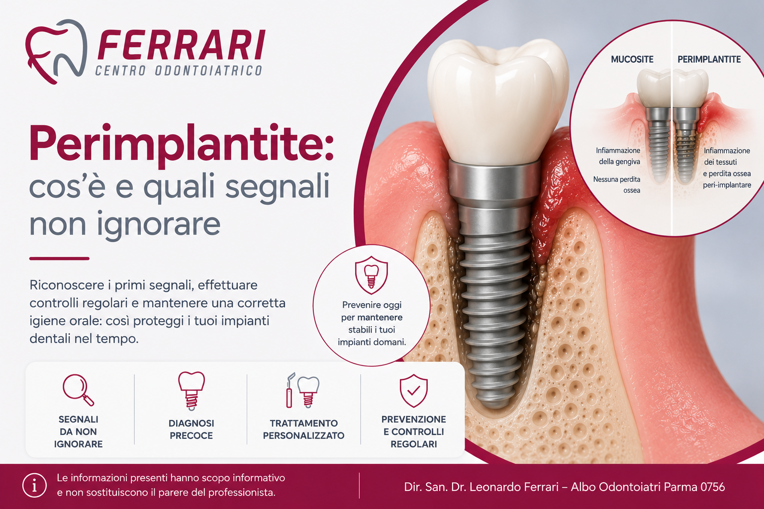 Perimplantite-articolo-centro-odontoiatrico-ferrari