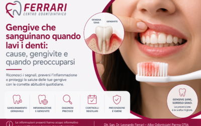 Gengive che sanguinano quando lavi i denti: cause, gengivite e cosa fare