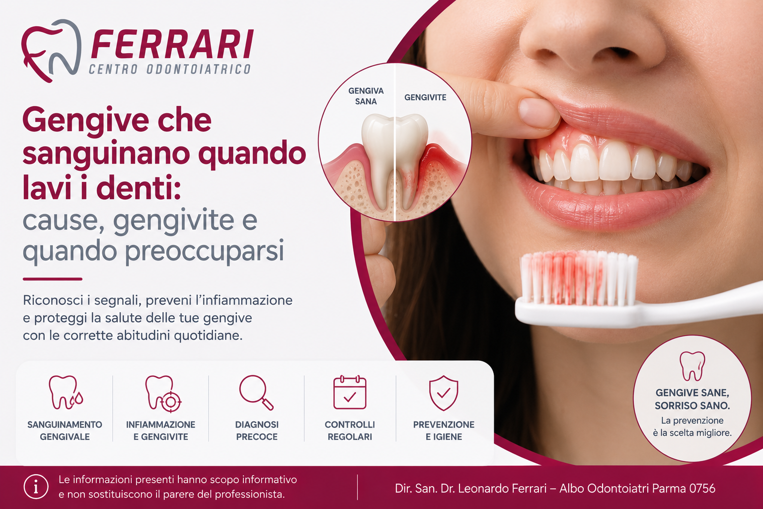 gengive-che-sanguinano-articolo-centro-odontoiatrico-ferrari