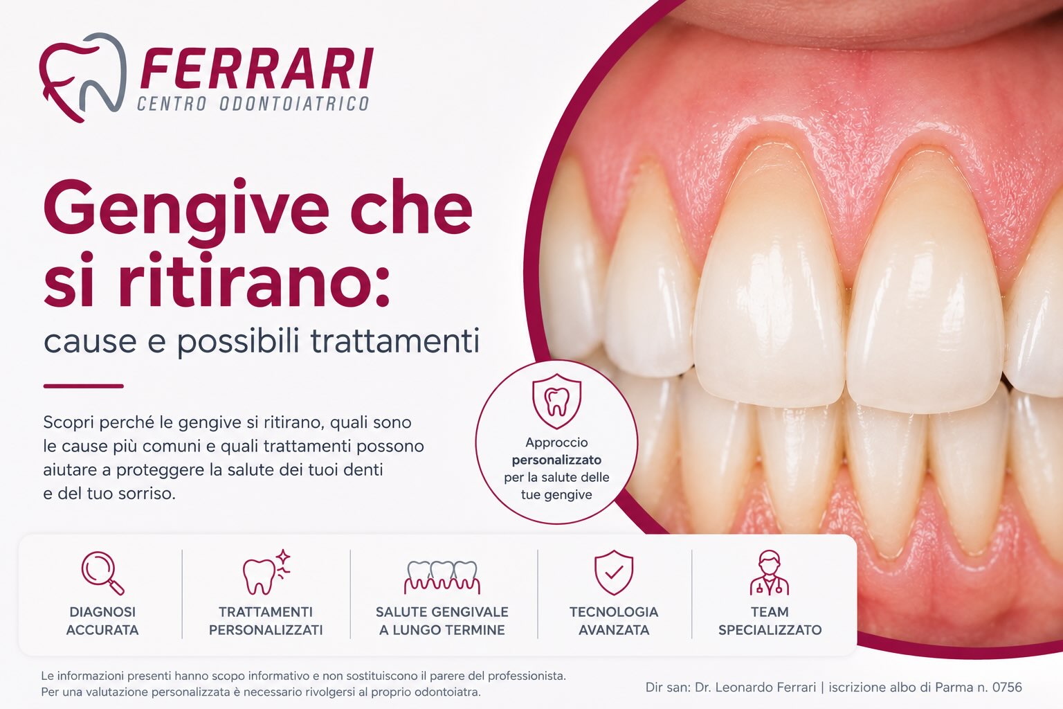 gengive-che-si-ritirano-cause-e-trattamenti