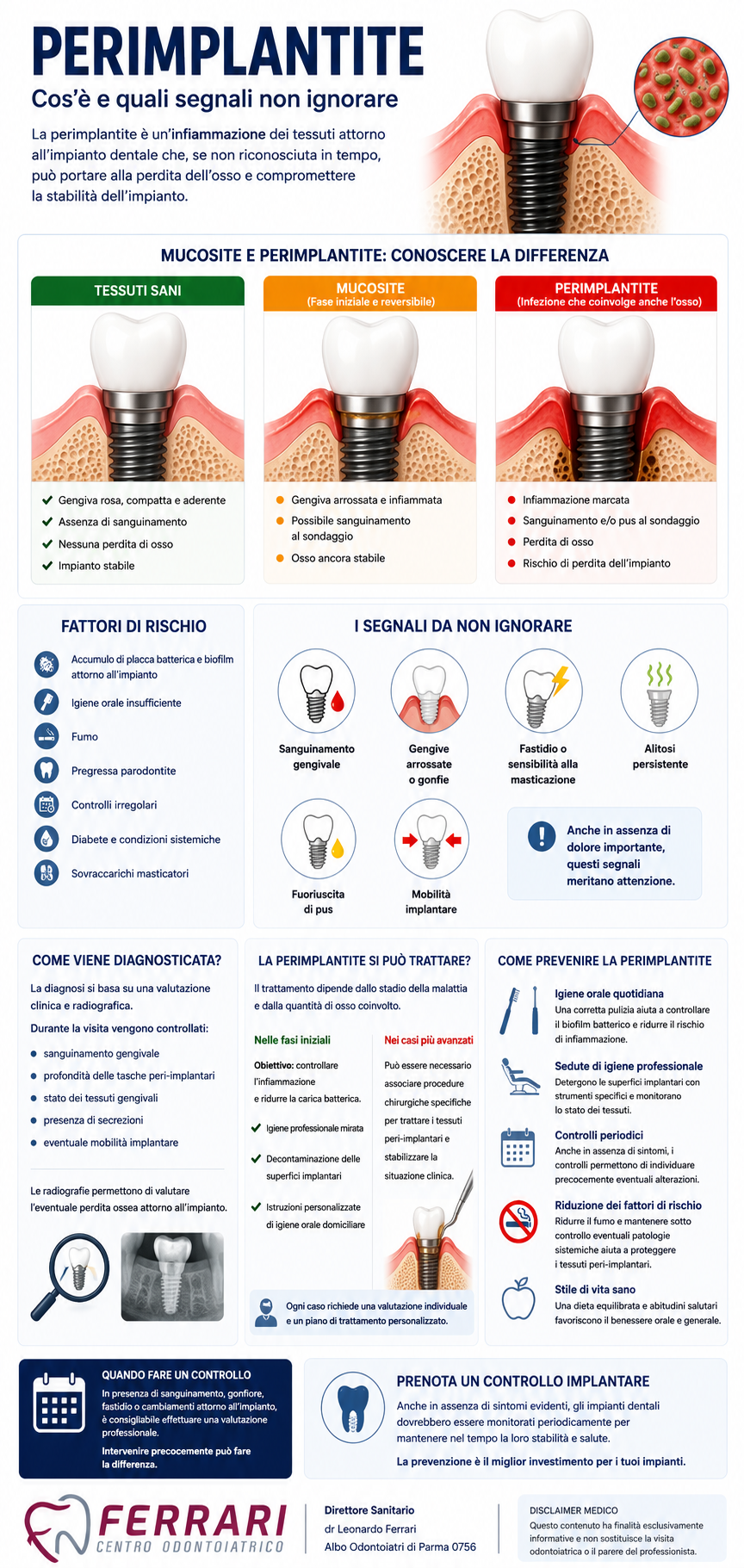 Infografica sulla perimplantite che mostra differenze tra mucosite e perimplantite, fattori di rischio, sintomi, diagnosi, trattamento e prevenzione degli impianti dentali.
