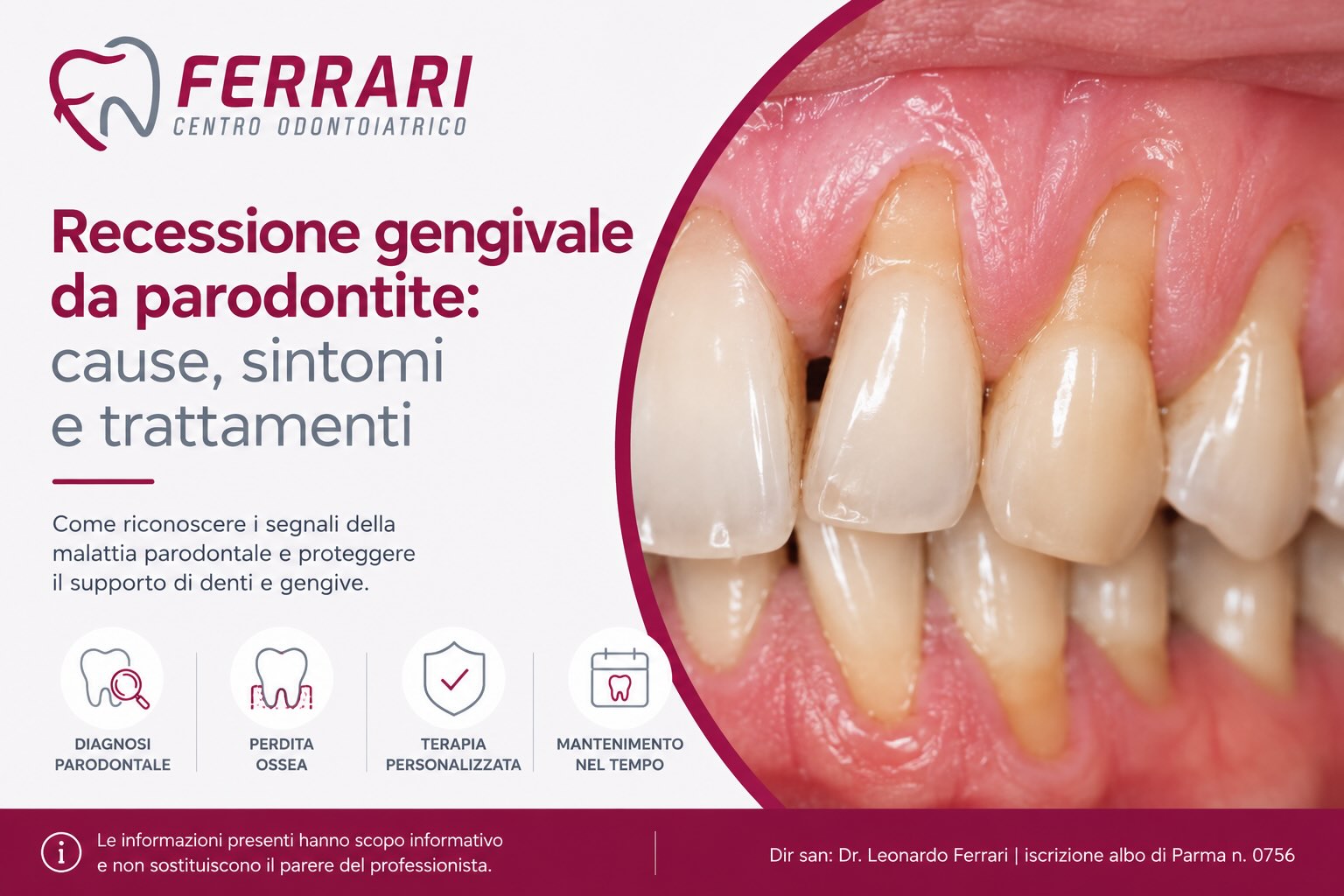 recessione-parodontite-cause-trattamenti