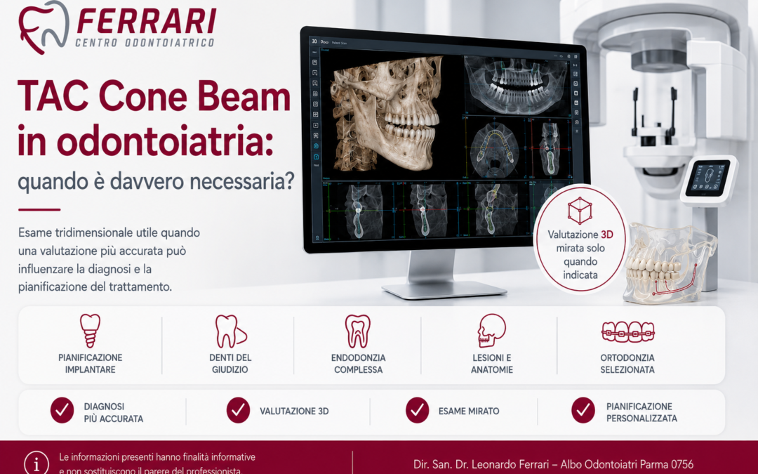 TAC Cone Beam in odontoiatria: quando è davvero necessaria?