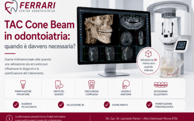 TAC Cone Beam in odontoiatria: quando è davvero necessaria?