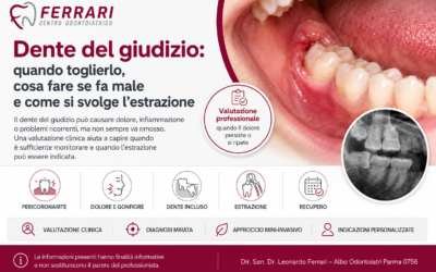 Dente del giudizio: quando toglierlo, rimedi e come avviene l’estrazione