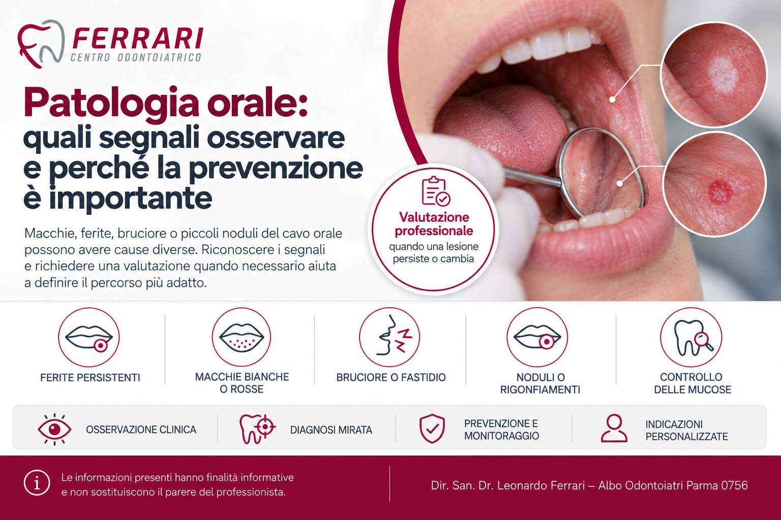 Patologia orale e prevenzione attenzione a mucose lingua e labbra